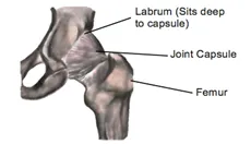 HIP PAIN AND LABRAL TEARS