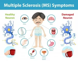 3 FACTS ON EXERCISE AND MULTIPLE SCLEROSIS (MS)